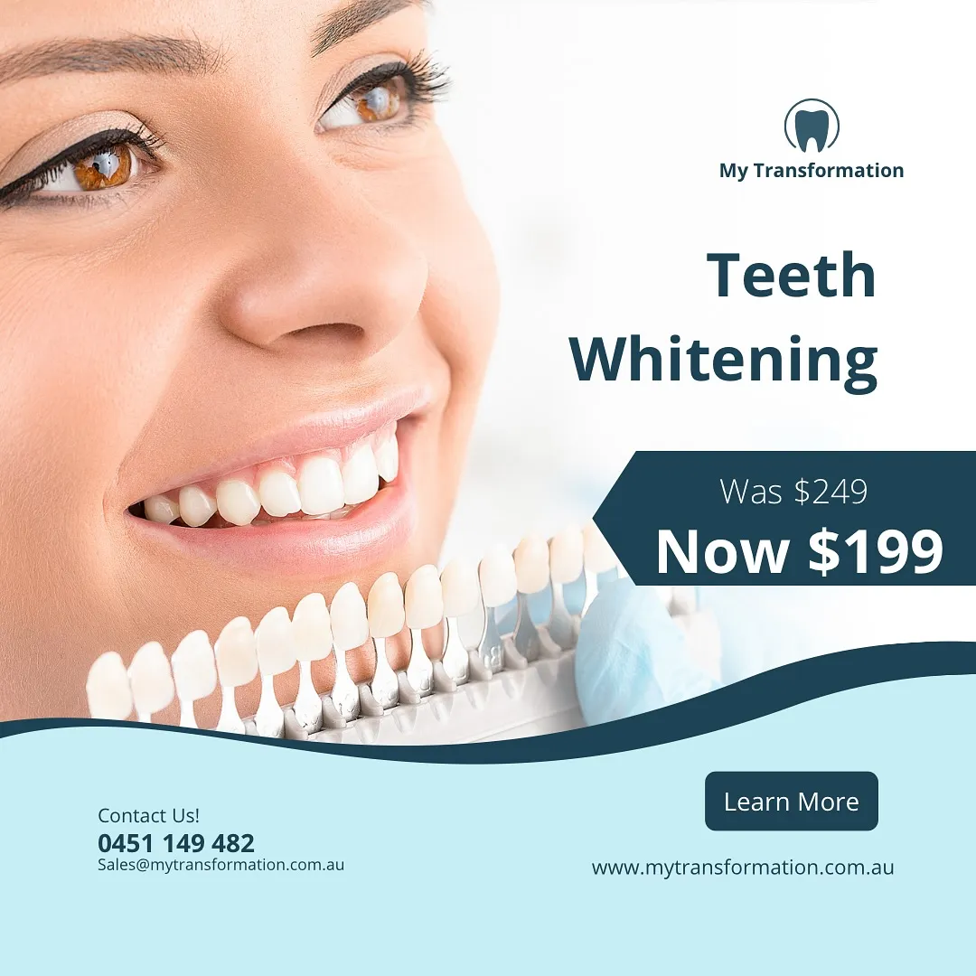 Perth Teeth Whitening Professional Teeth Whitening In 1 Hour